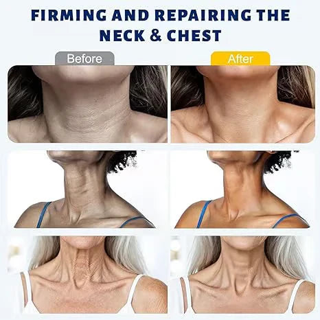 FirmSkin Neck™ - Collagen and Hyaluronic Acid Neck Cream | ELEGANTIEE
