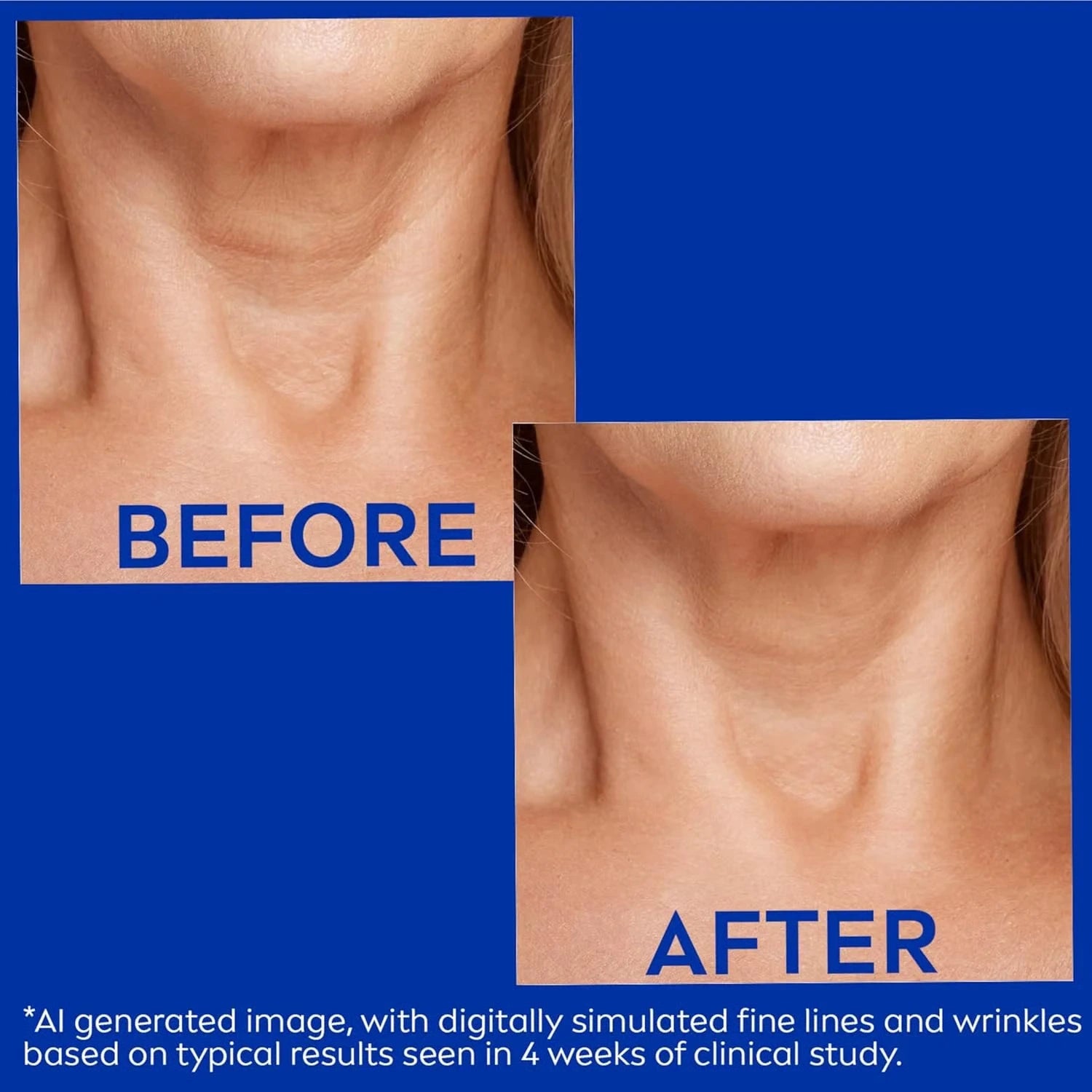 FirmSkin Neck™ - Collagen and Hyaluronic Acid Neck Cream | ELEGANTIEE