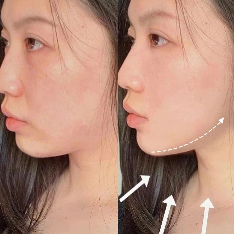 V-Revita™ - Facial Mask for Reducing Double Chin and Wrinkles | Elegantiee