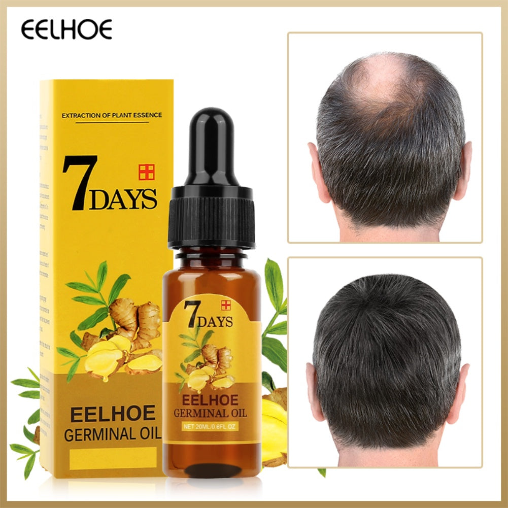 Ginger Hair | Oil for Hair Growth and Treatment of Baldness | Elegantiee
