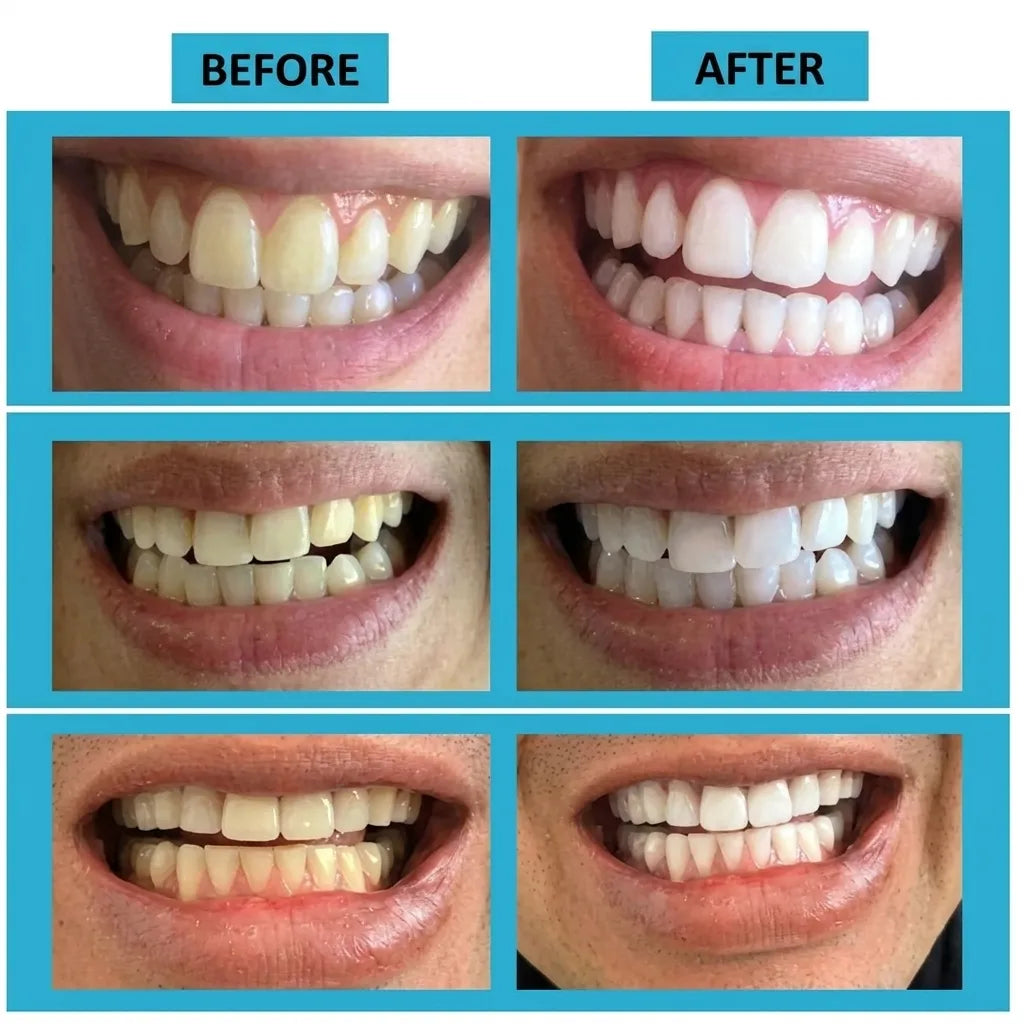 Teeth Cleaning and Whitening Powder | Elegantiee