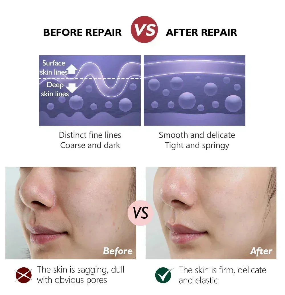 Anti-Aging Retinol Cream [Buy 2, get 3] - Elegantiee