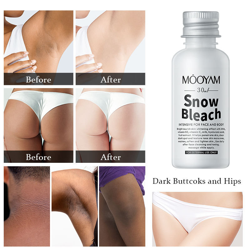 SnowBleach™️| Bleach Cream for Body Whitening