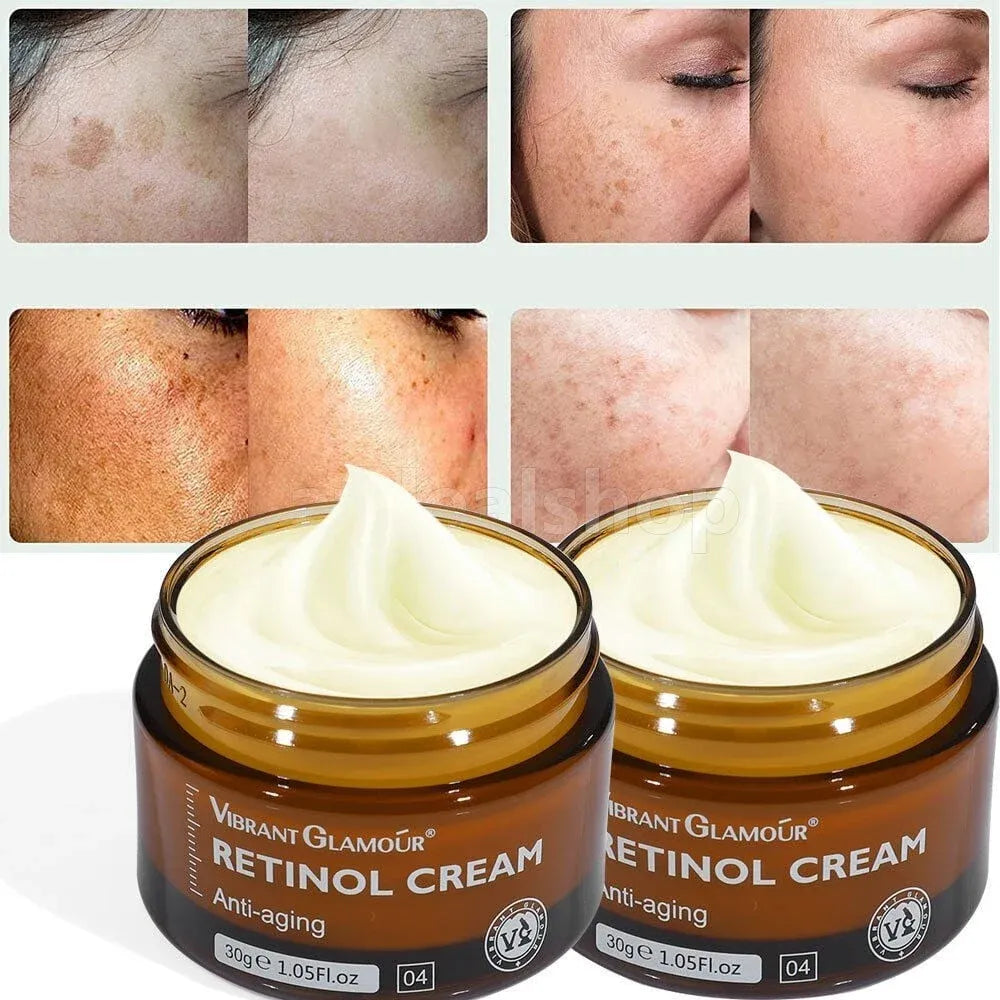 Anti-Aging Retinol Cream [Buy 2, get 3] - Elegantiee