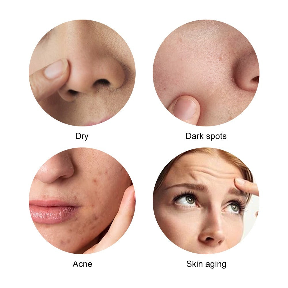 UltraSkin Lift™ Portable HIFU Ultrasound Device  - ELEGANTIEE
