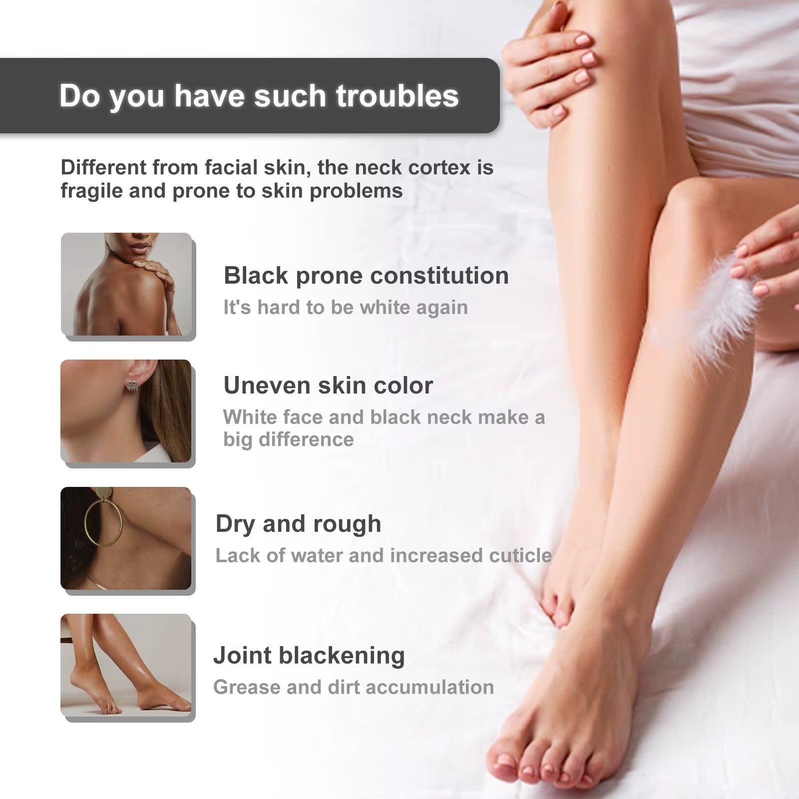 SnowBleach™️| Bleach Cream for Body Whitening