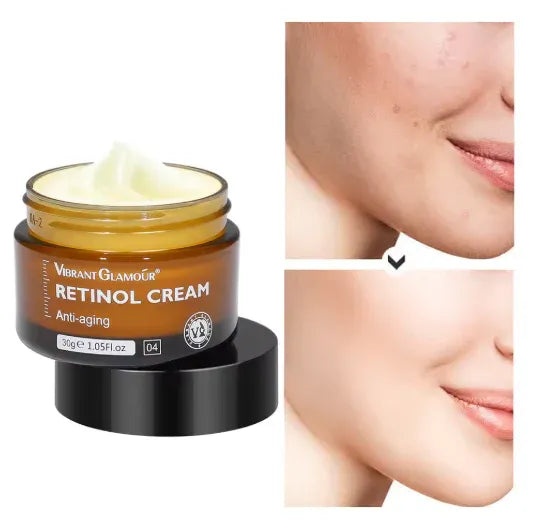 Anti-Aging Retinol Cream [Buy 2, get 3] - Elegantiee